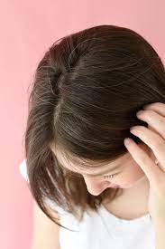 Diese dinge sollten sie über graue haare wissen: Ich Bin 25 Habe Graue Haare Und Stehe Dazu Elle