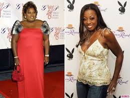 Pin On Celebrity Weight Loss Surgery