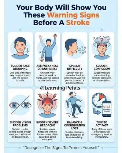 Your Body Will Show You These Warning Signs Before A Stroke Recognizing the early  signs of a stroke can be crucial for your health and well-being. Your body  often communicates warning signals