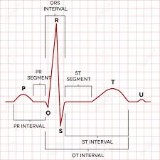 Human Heart Normal Sinus Rhythm Electrocardiogram Record Medical