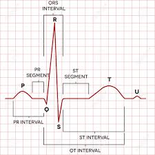 human heart normal sinus rhythm electrocardiogram record medical