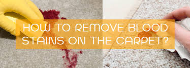 Here are a few simple steps you can take to most effectively clean small blood. How To Remove Blood Stains On The Carpet Sk Carpet Cleaning Services Melbourne