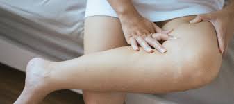 Trombose é um componente do sangue que é formado em vasos sanguíneos. Causas Da Trombose E A Sua Relacao Com Os Hormonios Vascular Clinica