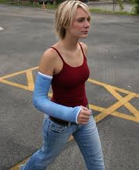 Image result for Long Arm Cast