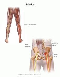 Pin On Exercises For Low Back Pain And Sciatica
