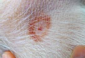 Ant Bites That Look Like Mosquito Bites 7 Common Bug Bites On Dogs And Cats Fly Bites Black Fly Bites Tick Bites On Dogs