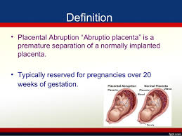 Failure of placental separation assoc with placenta previa ( 60 % ). Placental Abruption