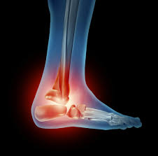 Laser Therapy For Heel Pain Foot Pain Relief Tri County Foot Ankle Center