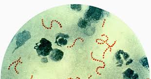 Image result for Streptococcus