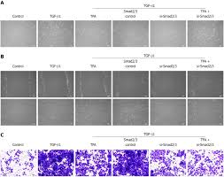 Total Flavone Of Abelmoschus Manihot Suppresses Epithelial