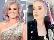 Kelly Osbourne Reveals She Had Surgery Prior to 85LB Weight Loss