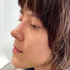 Dr. Juan Pablo Cadena (@drpablocadena) • Instagram photos and videos