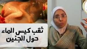 انفجار جيب الماء للجنين نزول ماء الرحم الحل الطبى الصحيح حسب شهور الحمل وليه خطر د ريهام الشال youtube