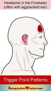 Headache In The Forehead Integrative Works In 2020 Headache Integrative Forehead
