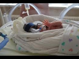 Unsere Fruhchen Wurden In Der 26 Ssw Mit Einem Gewicht Von 380g Und 880g Und Einer Grosse Von 26cm Und 32cm Gebor 26 Ssw 32 Ssw Fotografie Vom Neugeborenen Baby