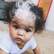 He looks pretty cute, in my opinion. This Baby Was Born With The Same White Hair Streak As Her Mom Allure