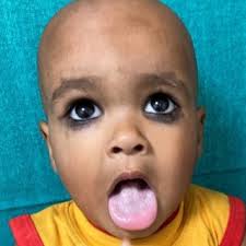 Solid model of mandible, articular fossa, upper jaw teeth and muscle...