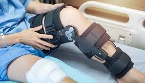 This type of tear is also caused by falls, direct force to the front of the knee. Knee Ligament Repair Johns Hopkins Medicine
