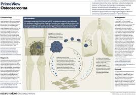 Image result for Osteosarcoma