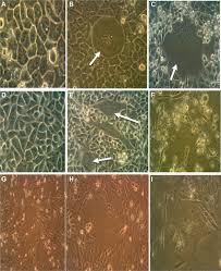 The 'vero' lineage was isolated from kidney epithelial cells extracted from an african green monkey (chlorocebus sp.; Propagation Of Measles Virus On Vero Rhabdomyosarcoma Rd And Angm5 Download Scientific Diagram