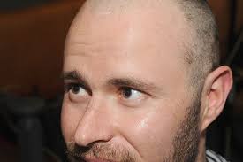 Head shave for North Louth Hospice