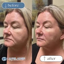 Laurel Asher's Instagram, Twitter & Facebook