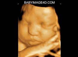 2d ultrasound with quick peek 4d hd; 3d Ultrasound For 35 Weeks 3d Ultrasound Ultrasound 4d Ultrasound