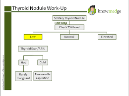 Abim Exam Prep How To Work Up A Thyroid Nodule Usmle