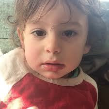 J needed a tooth out and was recovering nicely at home after a procedure  with anesthesia. We love cute messages like these from our amazing families!