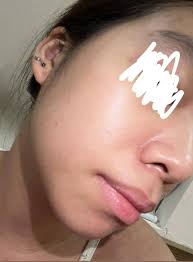 please what can my sister use to clear this