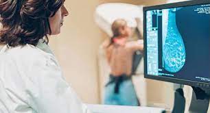 What age should women stop getting mammograms? Clearing Up The Confusion Over Recent Mammography Guidelines Breast Surgery Breast Oncology