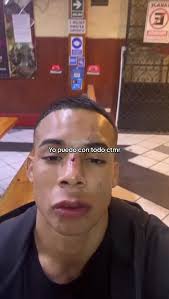 Mas gomeao jajajaja #fyp #parati