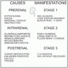 Image result for Postrenal Failure
