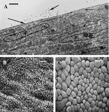 Viral, bacterial, tb, fungal, parasitic. The Mesothelial Cell Sciencedirect