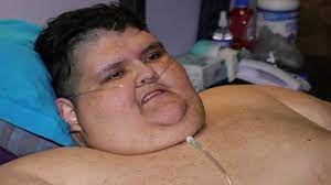 Andres moreno sepulveda, un mexicain de 38 ans, est décédé vendredi des suites d'une insuffisance cardiaque alors qu'il était en route pour l'hôpital, deux mois après une chirurgie bariatrique. Video Mexique L Homme Le Plus Gros Du Monde Temoigne Apres Son Operation De L Estomac Lci