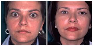 The Boston Globe Article