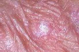 Image result for Oncinotis