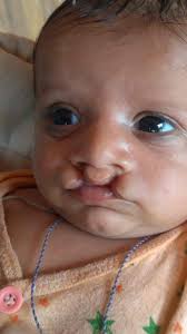 60 Reviews for Dr. Girish Amlani in Vidhyanagar Main Road, Rajkot