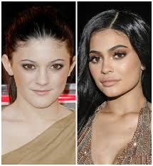* przeprowadzać w tym celu żadnych innych operacji przetwarzania danych dozwolonych w. Kylie Jenner Obchodzi 20 Urodziny Jak Sie Zmieniala Gala Pl