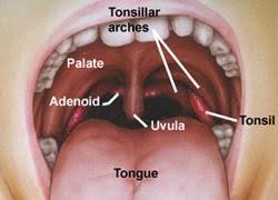 If tonsil stones are ignored and left in place without lifestyle changes, they may last for years. How To Prevent Tonsil Stones Dentist Net