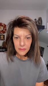 Michelle Eotb Psoriasis