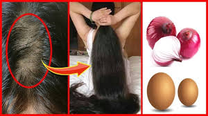 Surprising Hair Grow Long And Stop Hair Fall With Onion Super Fast Ha Grow Long Hair Fast Hairstyles Egg For Hair