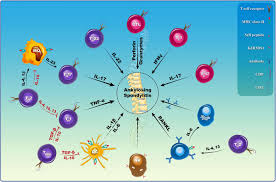 Ankylosing Spondylitis Etiology Pathogenesis And Treatments Bone Research