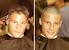 Buzz Cut Diffuse Thinning