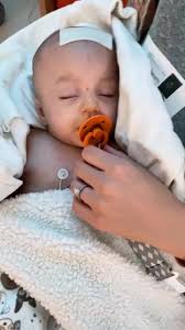 Always my little ✨rockstar✨ #craniosynostosis