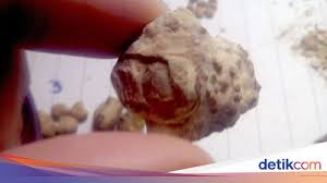 Maybe you would like to learn more about one of these? 8 Obat Batu Ginjal Tanpa Operasi
