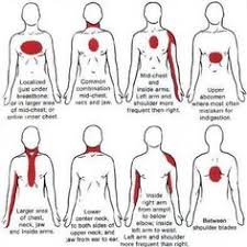 The chest wall including the ribs, the muscles, and the skin. 53 Cardiac Heart Vascular Diseases Ideas Congenital Heart Disease Congenital Heart Enlarged Heart