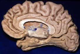 Sawing the brain in half could cause more damage to the tissue, making identifying structures more difficult. Midsagittal View Of Cerebrum Neuroanatomy The Neurosurgical Atlas