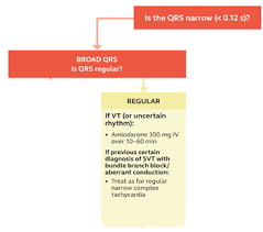 Image result for Ventricular Fibrillation Management in the Adult