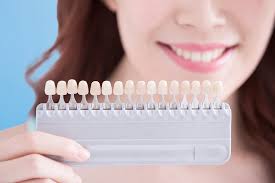 Tooth Bonding in Boston | Tooth Bonding Near You